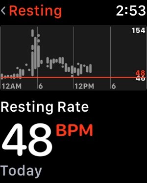 fullsizeoutput_1533.jpeg fullsizeoutput_1533.jpeg